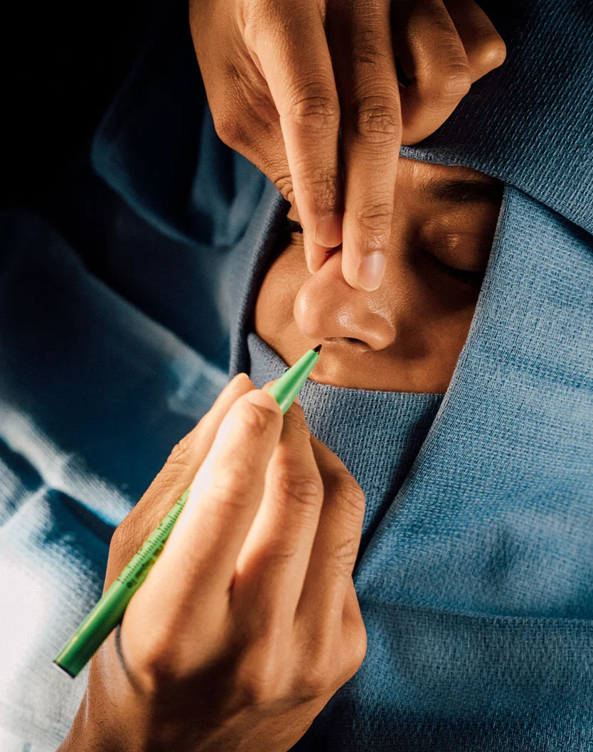 Close-up of a person's face with a green marker near the nose. The person wears a light-blue surgical gown. A medical professional's hands are holding the tool, with fingers positioned near the nose, possibly making or adjusting markings. Focused lighting highlights the face and hands, suggesting a surgical or procedure-related context. - Nostril Reduction in Glenview, IL