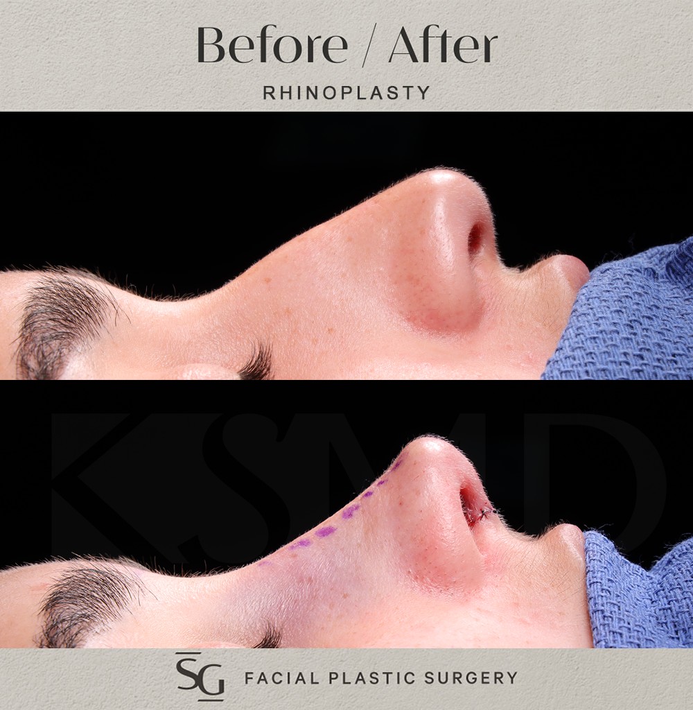 AG-profile-1-intraop