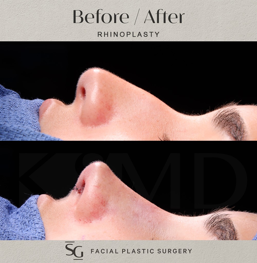 AG-profile-2-intraop