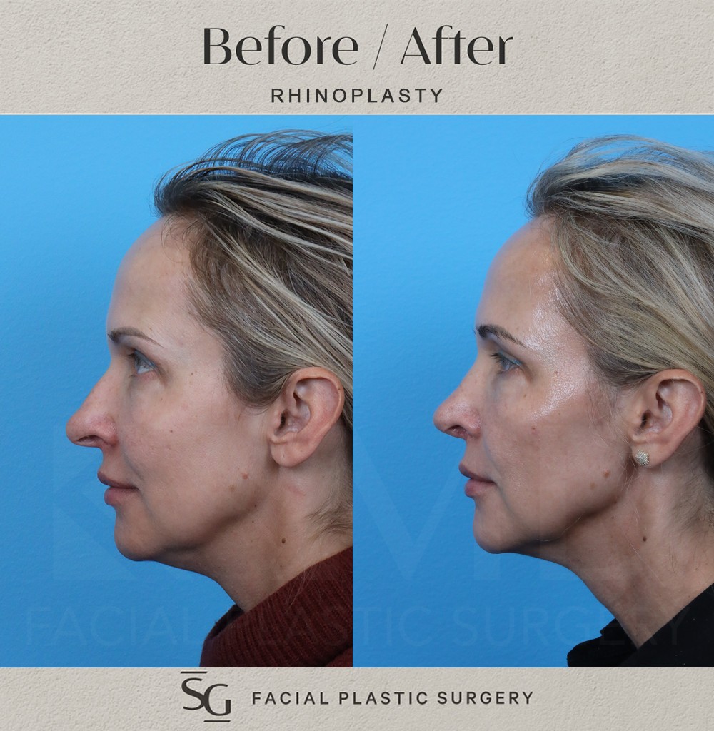 AS-6-month-profile-1