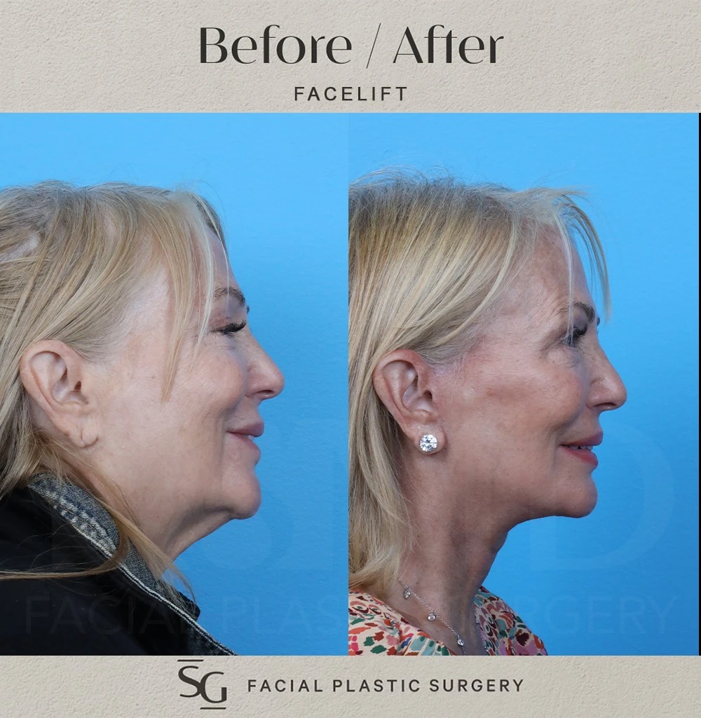 KR Profile 2 smile