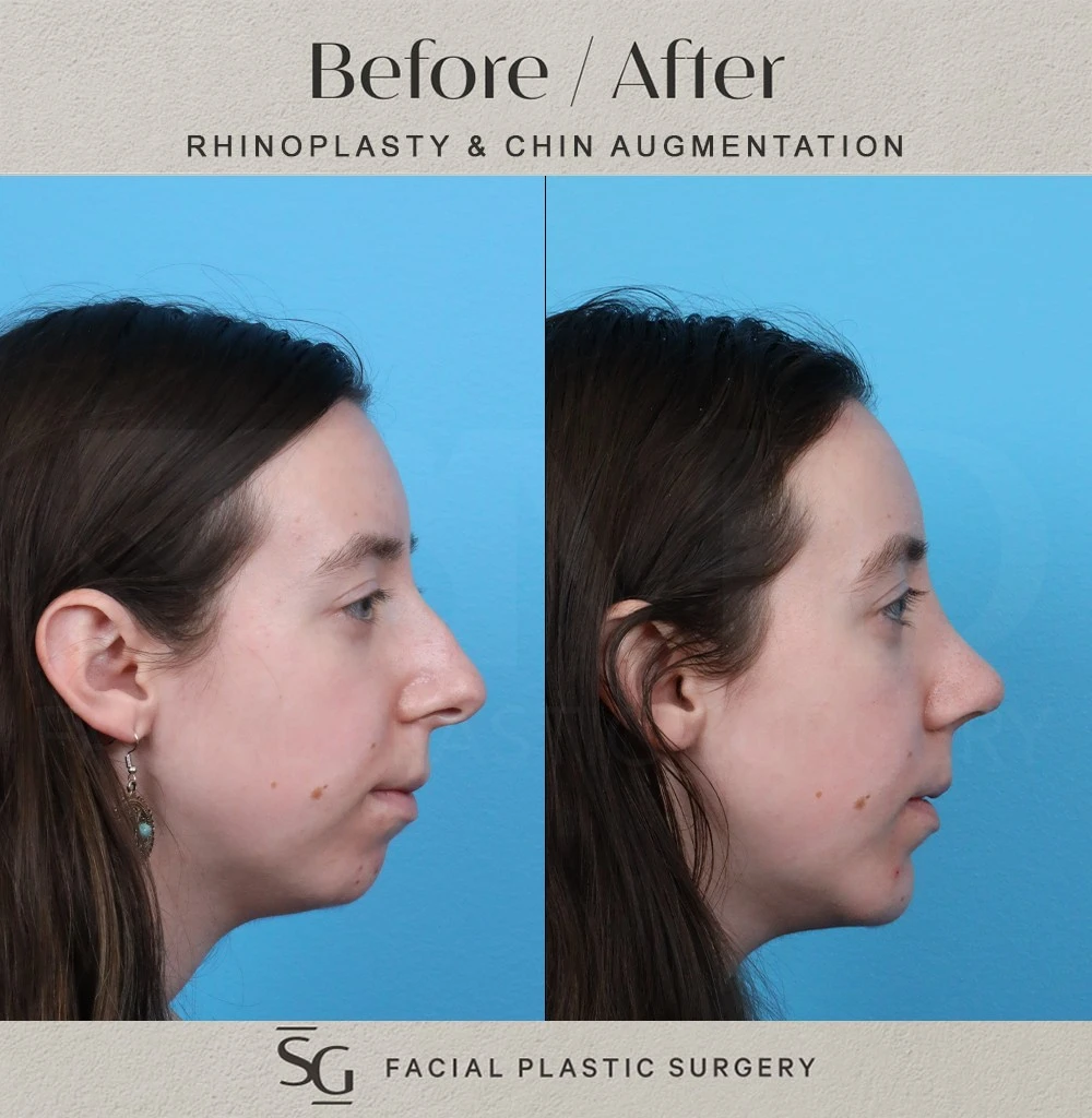 MK 3 month profile