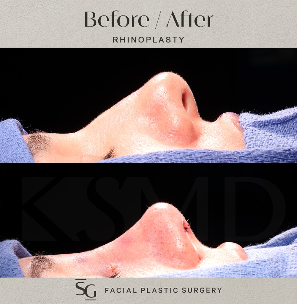 MG-profile-1-intraop