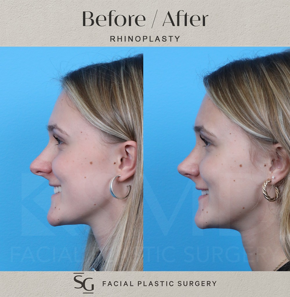 6-wk-profile1-smile
