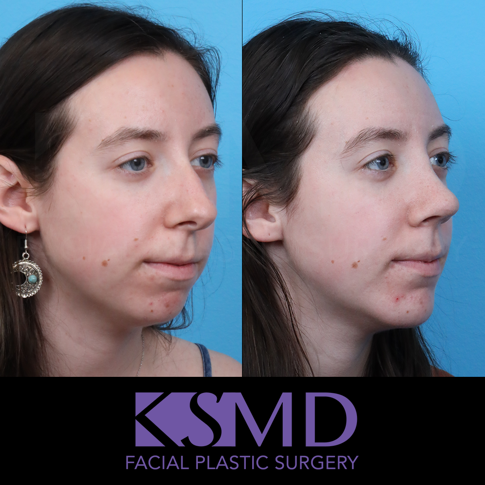 MG 3 month oblique 2