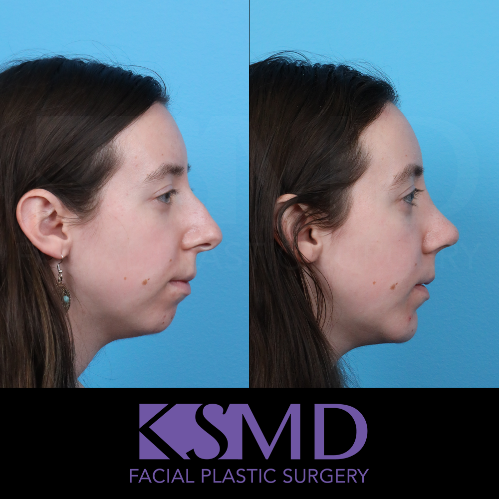 MK 3 month profile 2